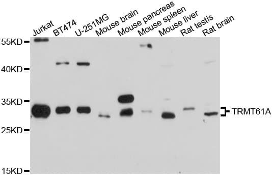 Polyclonal Rabbit anti-Human TRMT61A / TRM61 Antibody (WB)