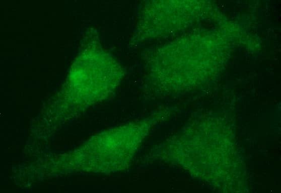 RAB21 Antibody (clone OTI6G3)
