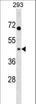 Polyclonal Rabbit anti-Human MRPL39 Antibody (aa302-330, WB)