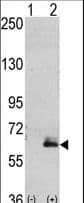 Polyclonal Rabbit anti-Human MAP2 Antibody (aa1766-1796, IHC, WB)