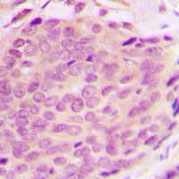RNF125 / TRAC-1 Antibody (Internal)