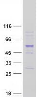 Human TUBB7P Protein (Recombinant Myc-DDK (Flag))