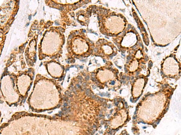 NPC2 Antibody