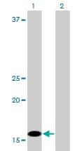Monoclonal Mouse anti-Human C1D Antibody (clone 6H2, IF, WB)