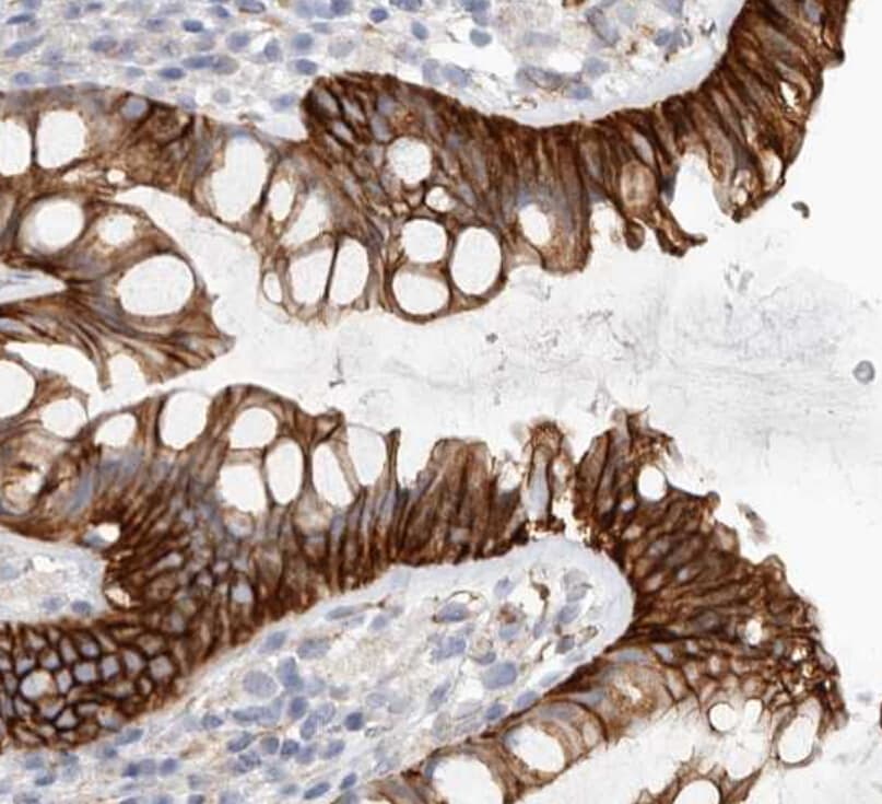 Polyclonal Rabbit anti-Human CTNNB1 / Beta Catenin Antibody (IHC, IF, WB)