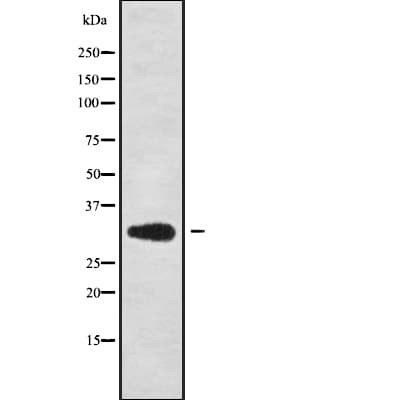 Polyclonal Rabbit anti-Human OTUB1 / OTU1 Antibody (IHC, IF, WB)