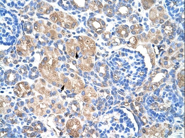 Polyclonal Rabbit anti-Human HSPB1 / HSP27 Antibody (C-Terminus, IHC, WB)