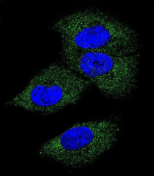 CSF1 / MCSF Antibody (aa230-257)
