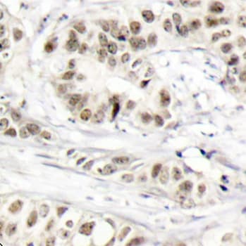 BRCA1 Antibody (phospho-Ser1524)