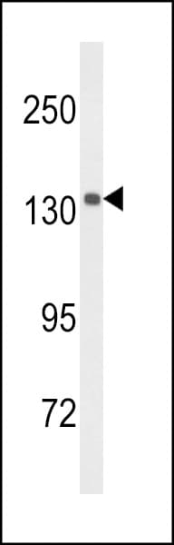 UTY Antibody (aa1247-1276)