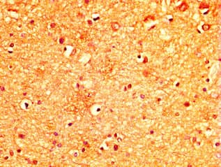 MYO5A / Myosin V Antibody