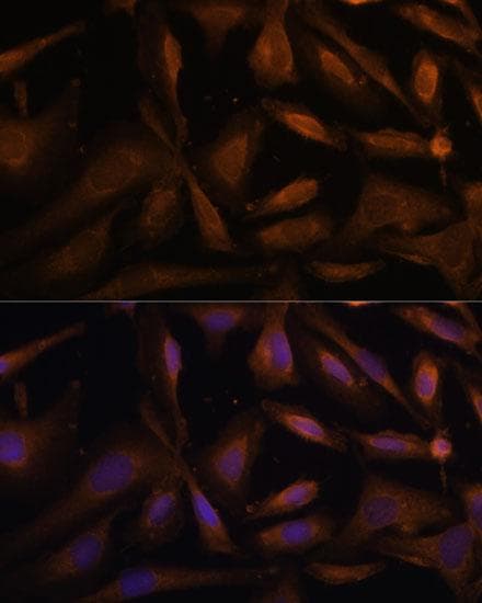 Polyclonal Rabbit anti-Human UFC1 Antibody (IF)