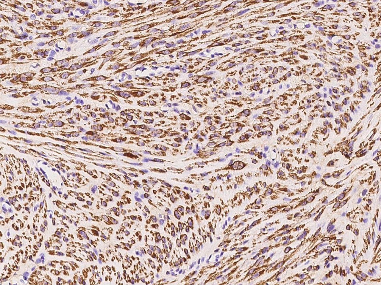 DES / Desmin Antibody (Preservative Free)