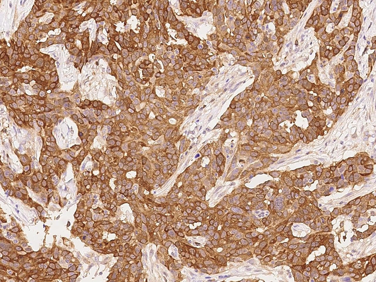 PHGDH Antibody