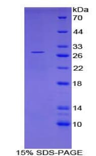 Mouse PVRL2 / CD112 Protein (Recombinant His-T7)