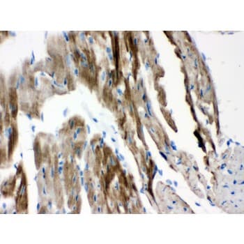 VDAC1 / PORIN Antibody (aa154-181)