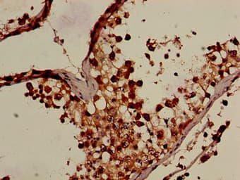 Polyclonal Rabbit anti-Human OS9 Antibody (IHC, IF, WB)
