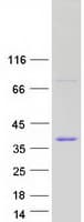 Human BEND5 Protein (Recombinant Myc-DDK (Flag))