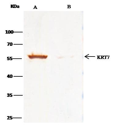 KRT7 / CK7 / Cytokeratin 7 Antibody (Preservative Free)