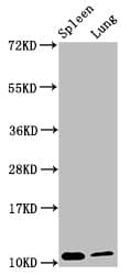 S100A8 / MRP8 Antibody (aa1-93)
