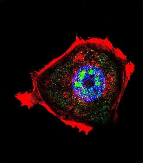 Polyclonal Rabbit anti-Human AKT1 Antibody (phospho-Thr308, IF)