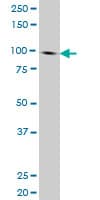 Monoclonal Mouse anti-Human NBN / Nibrin Antibody (clone 3E4, WB)