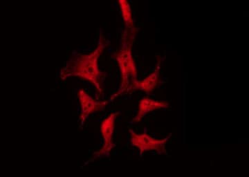 TYK2 Antibody