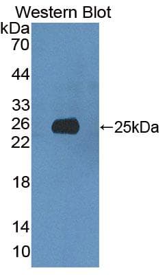 XRN1 Antibody