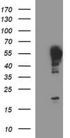 TUBB2A / Tubulin Beta 2A Antibody (clone OTI1H3)