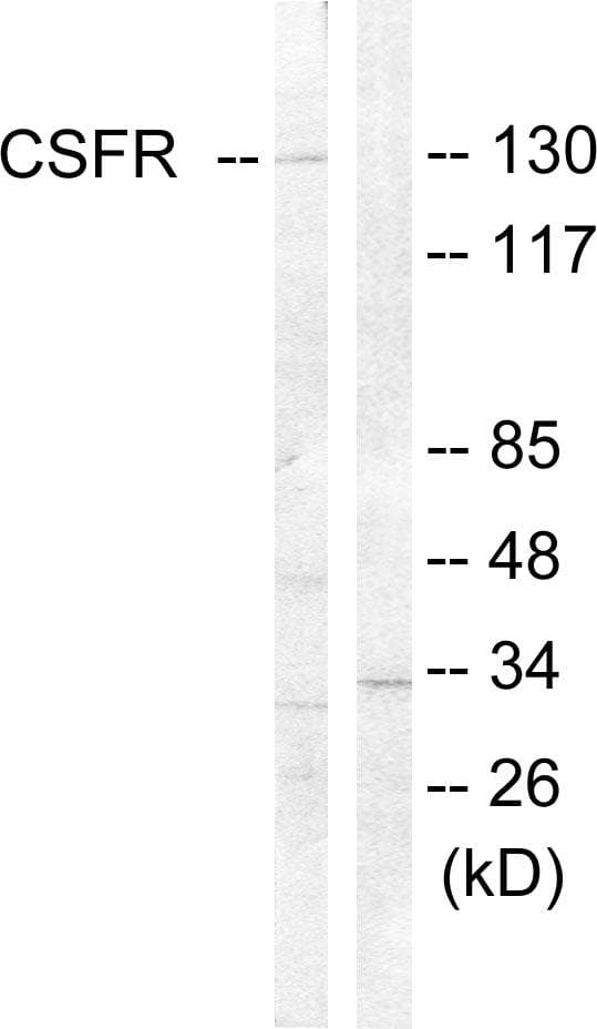 CSF1R / CD115 / FMS Antibody (p809)