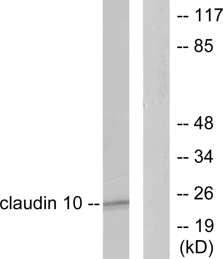CLDN10 / Claudin 10 Antibody (aa179-228)