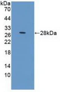 PRLR / Prolactin Receptor Antibody (aa25-234)