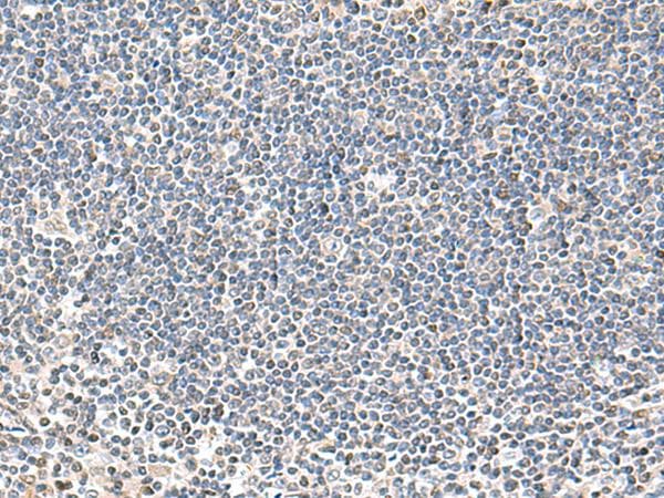 IFNA2 / Interferon Alpha 2 Antibody