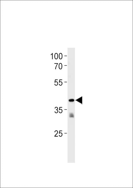 Polyclonal Rabbit anti-Human TAAR2 / GPR58 Antibody (aa1-30, WB)