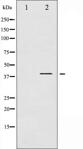 ADRB2 Antibody (phospho-Ser346)