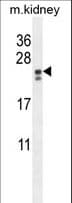 PIGX Antibody (aa67-95)