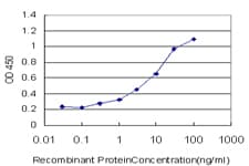 Monoclonal Mouse anti-Human FOXO3 / FOXO3A Antibody (clone 2C4, IHC, IF, WB)