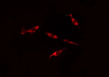 Polyclonal Rabbit anti-Human PSMD6 Antibody (IF, WB)