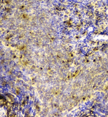 SCN4B Antibody