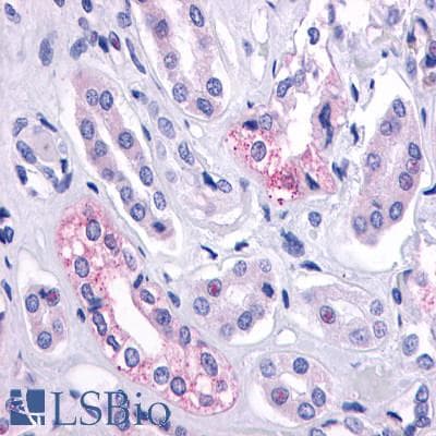 PathPlus™ AVPR2 / V2R Antibody (C-Terminus)