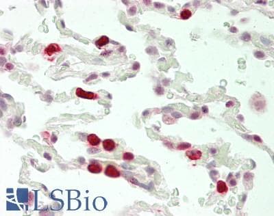 IHC-plus™ METTL3 Antibody (aa530-580)