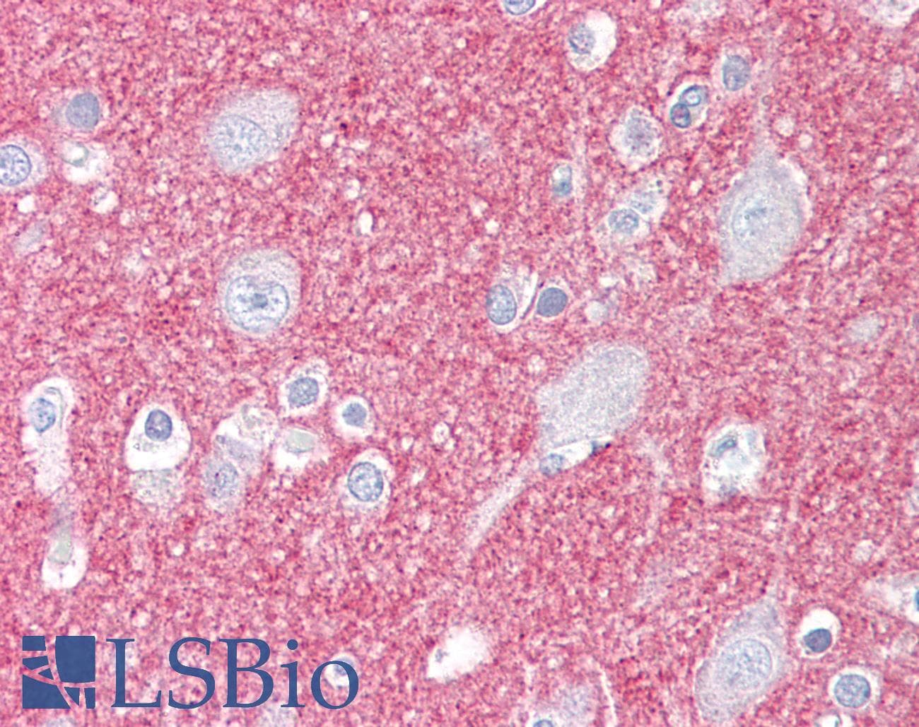 IHC-plus™ SIRPA / CD172a Antibody (aa451-500)