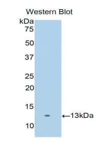 SERPINA12 / Vaspin Antibody (aa52-143)