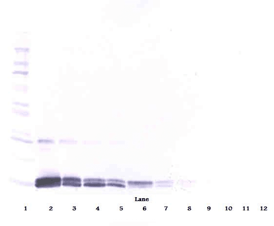 PGF / PLGF Antibody