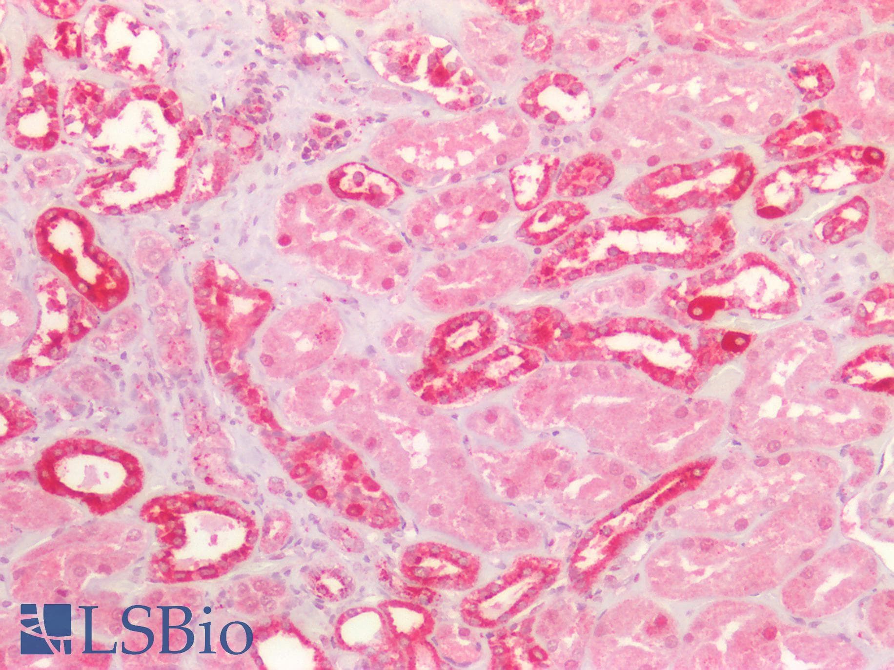 PathPlus™ Polyclonal Rabbit anti-Human AXIN2 / Axin 2 Antibody (IHC, IF, WB)