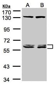 Polyclonal Rabbit anti-Human DNAJC7 Antibody (aa151-473, IHC, WB)