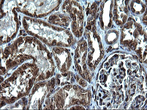 CD74 / CLIP Antibody (clone OTI1H3)