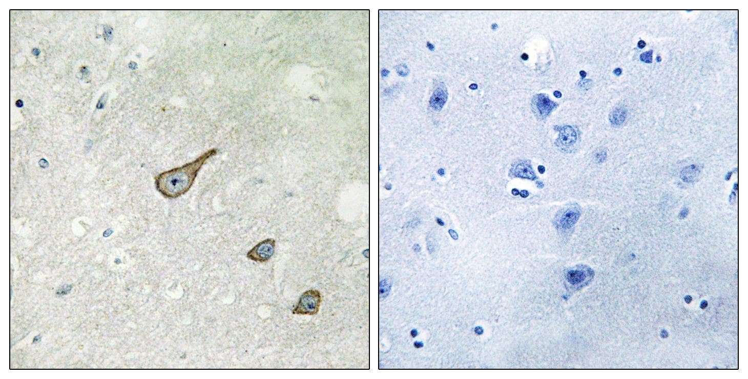 DGKK Antibody