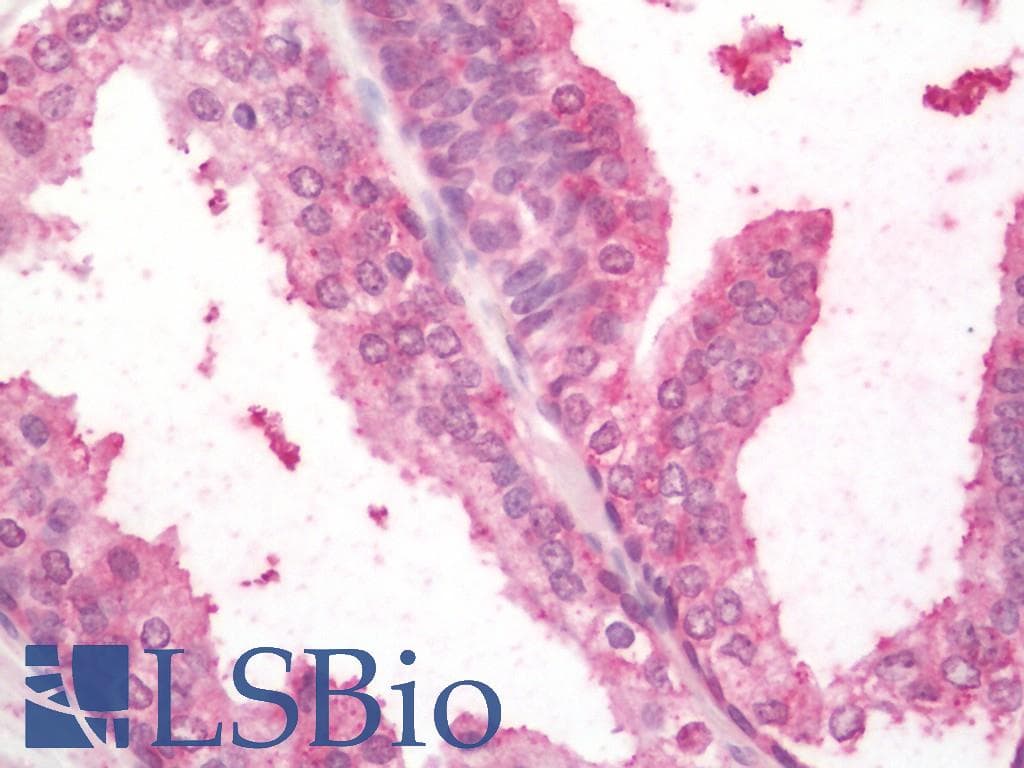 TGFB2 / TGF Beta2 Antibody (HRP)