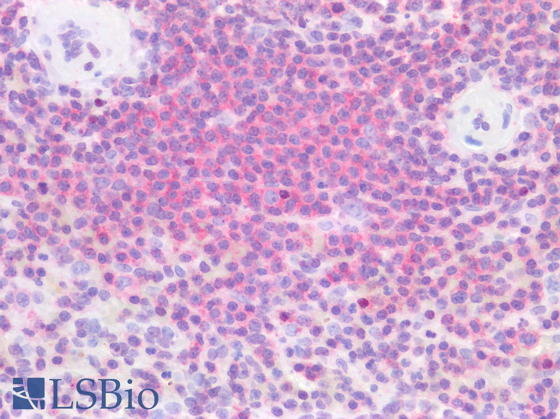 IHC-plus™ Polyclonal Rabbit anti-Human HMG1 / HMGB1 Antibody (Acetyl-Lys12, IHC, WB)